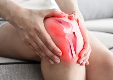 Woman with knee pain