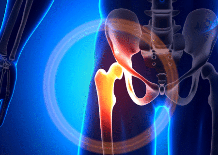 chronic hip pain
