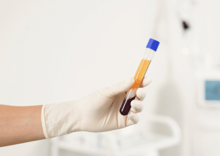platelet-rich plasma
