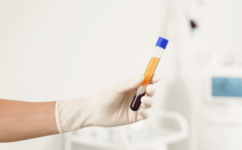 platelet-rich plasma