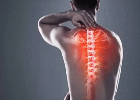 understanding kyphoplasty