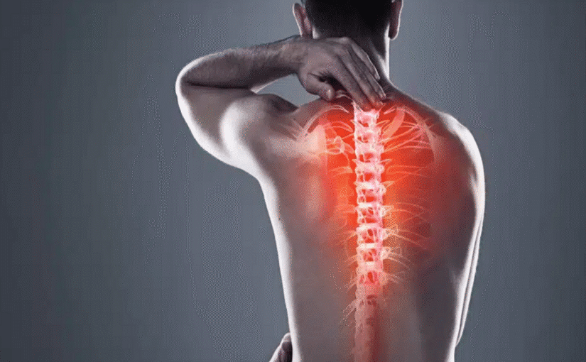understanding kyphoplasty