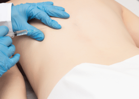treating chronic pain with trigger point injections