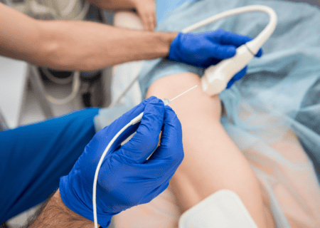 radiofrequency ablation