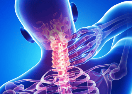 stellate ganglion blocks