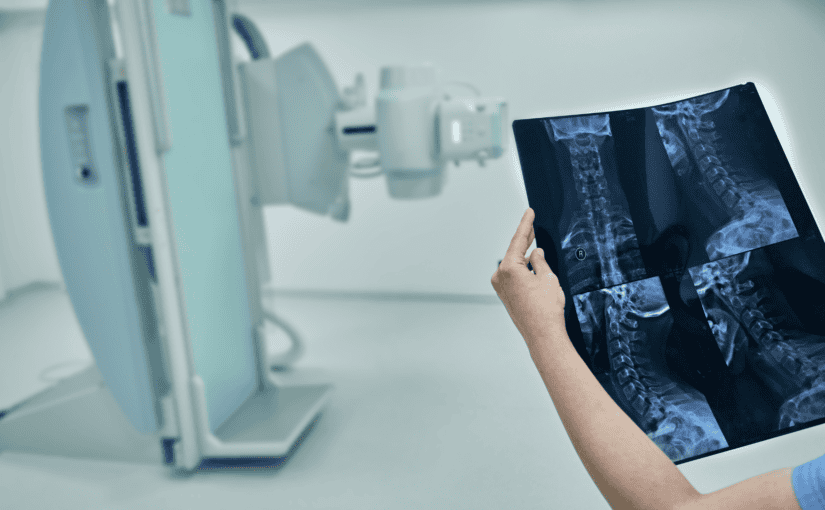 diagnostic imaging for spine pain