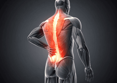 nerve pain in the spine